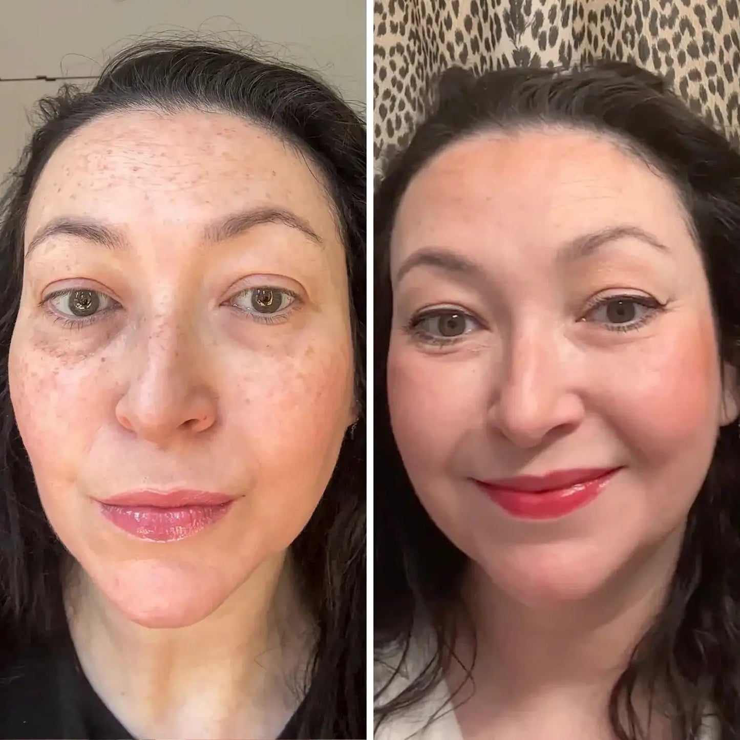 🔥Final 3 Hours : Only Limited Stock Left💖ALL-IN-ONE BALM FOR UNDER-EYE RENEWAL